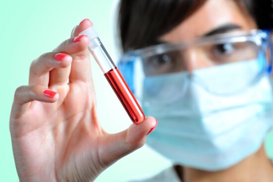 Point of Care Lab Testing